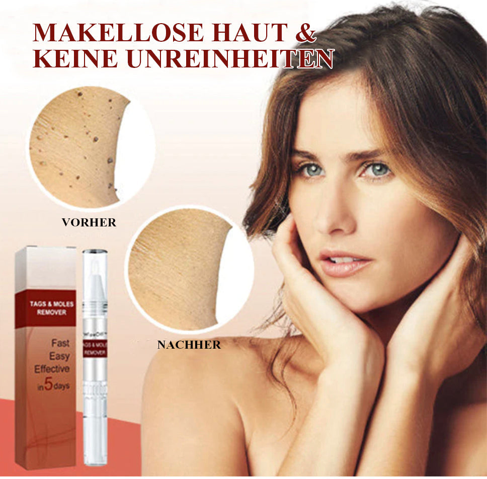 1+1 Gratis | WipeOff - Hautmakel- und Muttermal Entferner