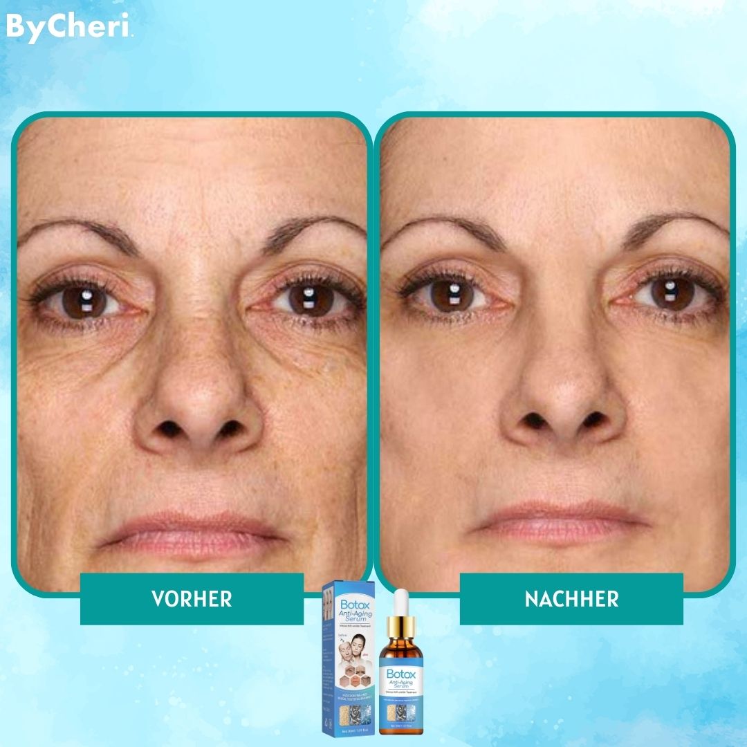 1+1 Gratis | YouthGlow - Botox Antialterung Serum