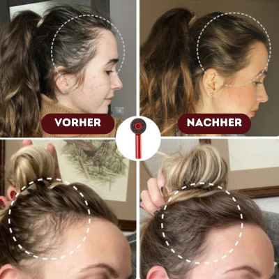 ScalpRelax™ – Massagekamm mit Öl-Infusion und Rotlichttherapie