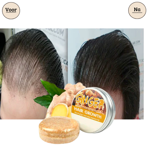 1+1 Gratis | ReGrow - Schluss mit Haarausfall!
