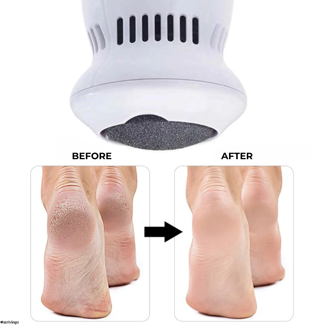 HeelClean™ – Elektrische Fußfeile mit Vakuum