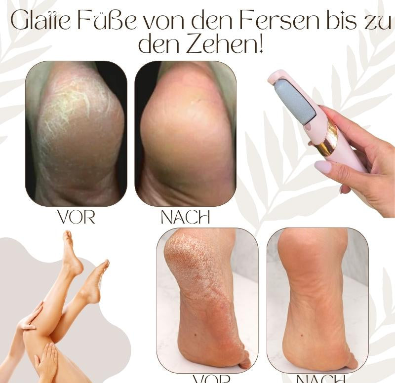 Callusos™ – Elektrischer Hornhautentferner