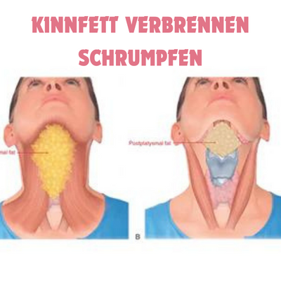 1+1 Gratis | FaceShape - Vakuum-Gesichtstrainer