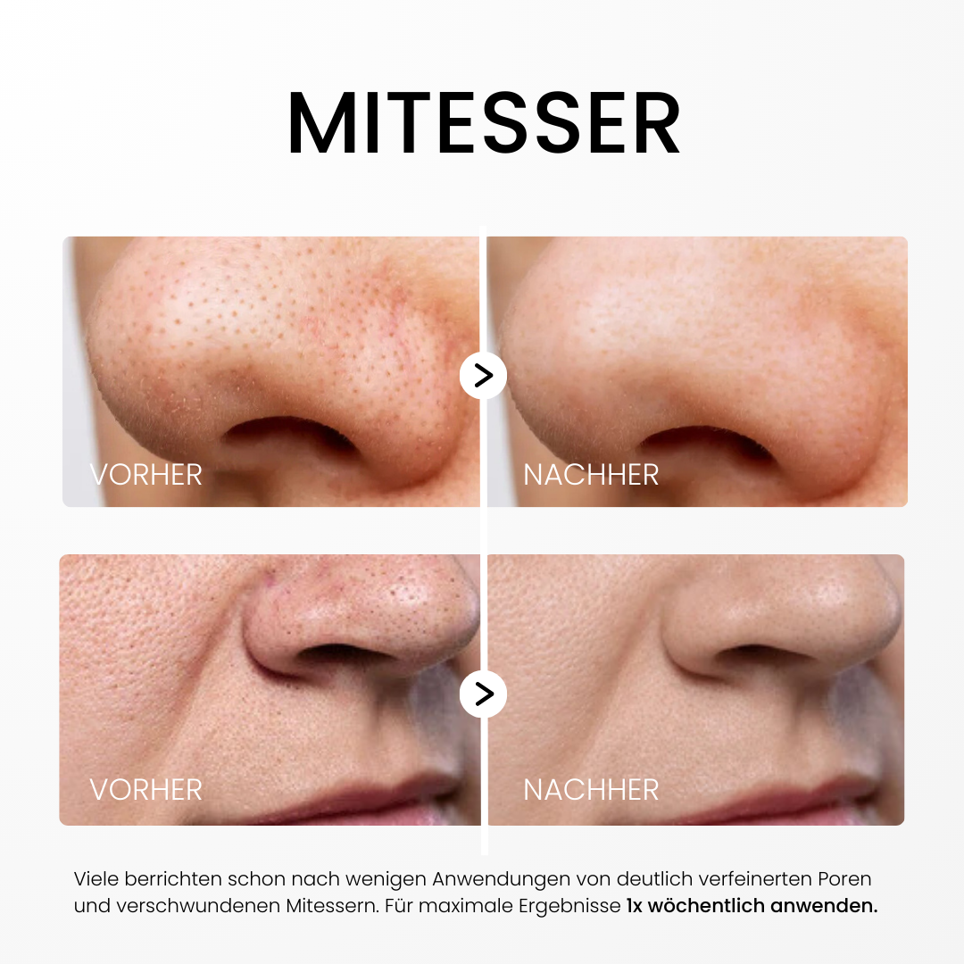 Reis Peeling Serum für Damen | Mit Reisextrakt, nachfüllbar | Für strahlende, ebenmäßige Haut mit sanftem Peeling-Effekt 5