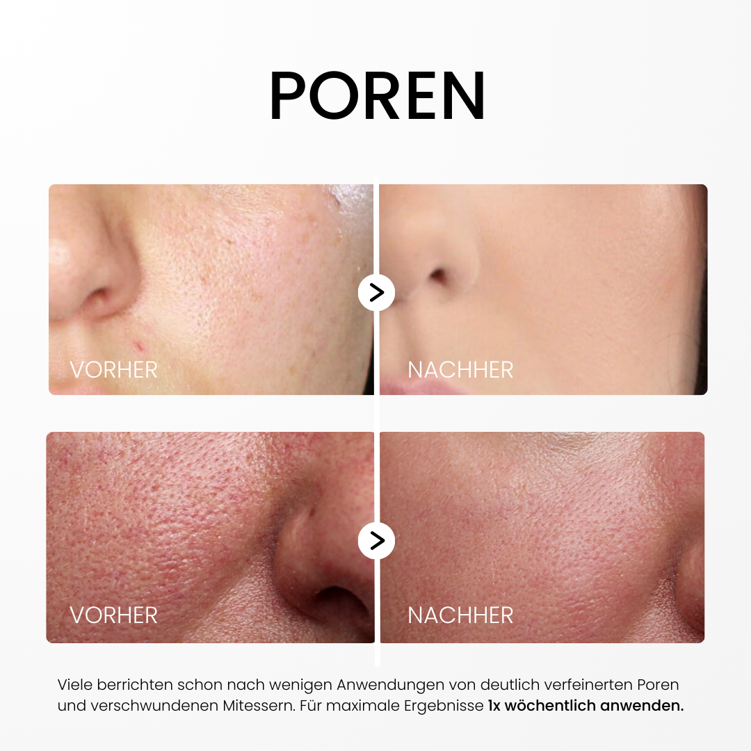 Reis Peeling Serum für Damen | Mit Reisextrakt, nachfüllbar | Für strahlende, ebenmäßige Haut mit sanftem Peeling-Effekt 4