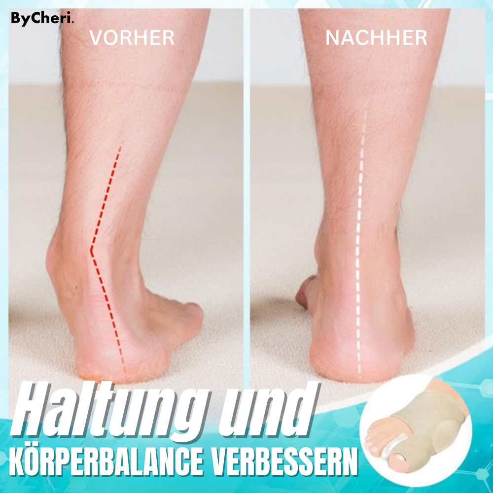 1+1 Gratis | Dr.Fit - Ballenzeh-Korrekturhülse