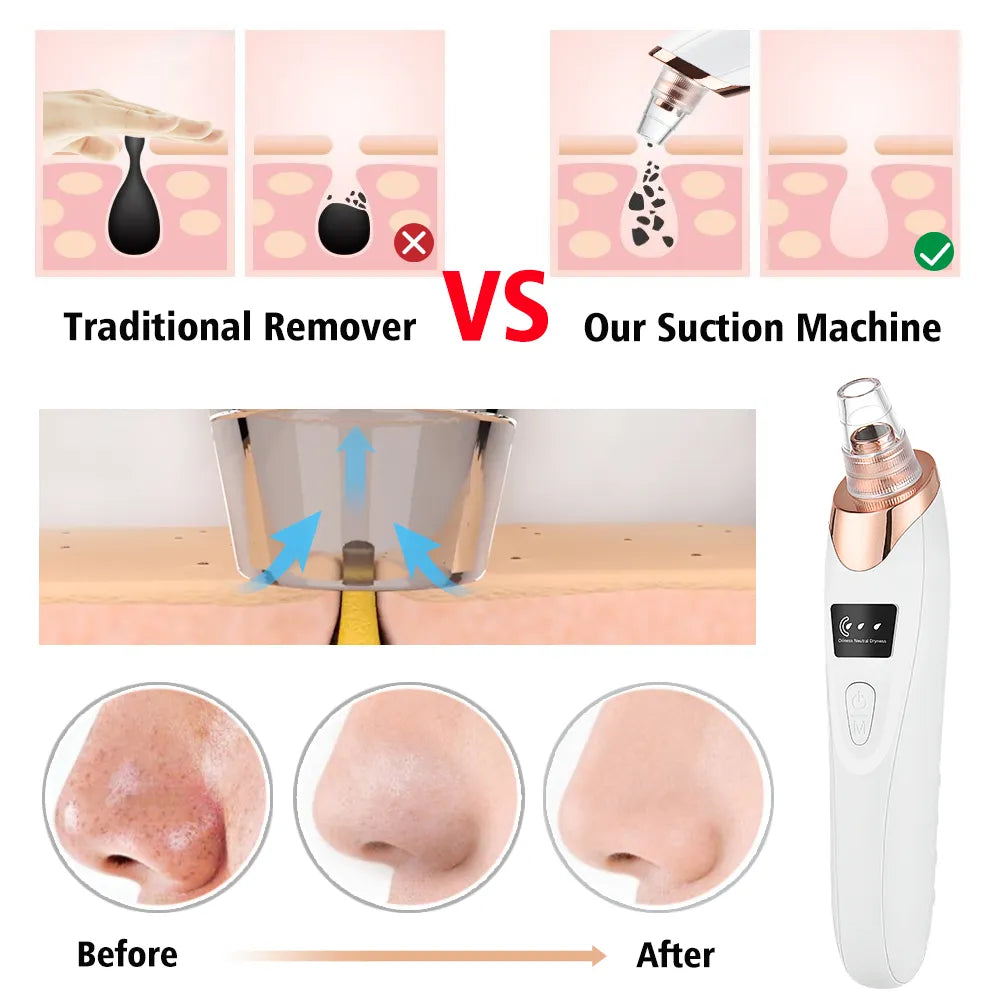 Glamvac Cleaner™ - Hautpflege und Verjüngung