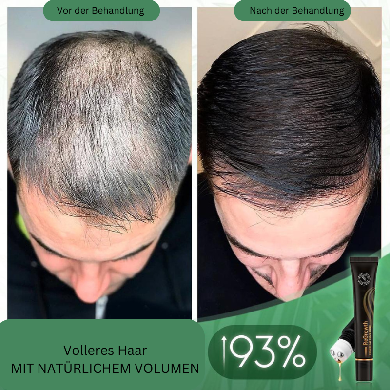 1+1 Gratis | BoostHair - Bio-Haarserum-Walze