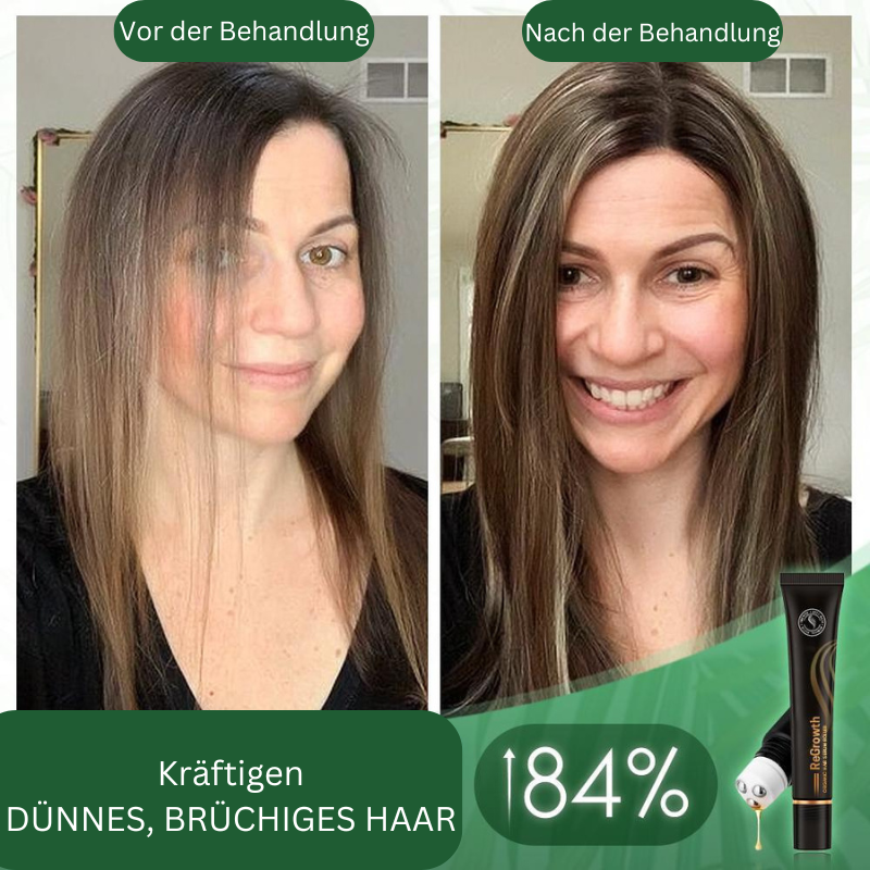 1+1 Gratis | BoostHair - Bio-Haarserum-Walze