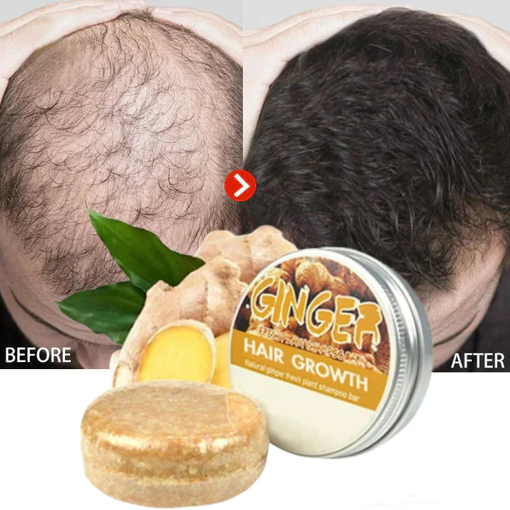 1+1 Gratis | ReGrow - Schluss mit Haarausfall!