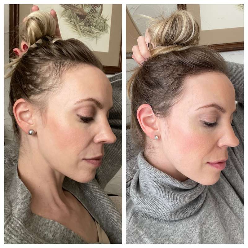 1+1 Gratis | ReGrow - Schluss mit Haarausfall!