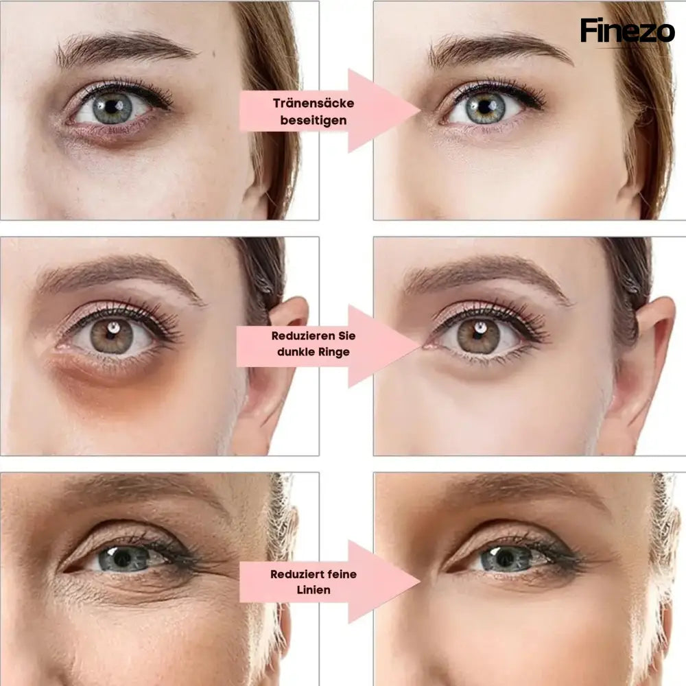 GlamorousEyes™ – Für strahlende und wache Augen