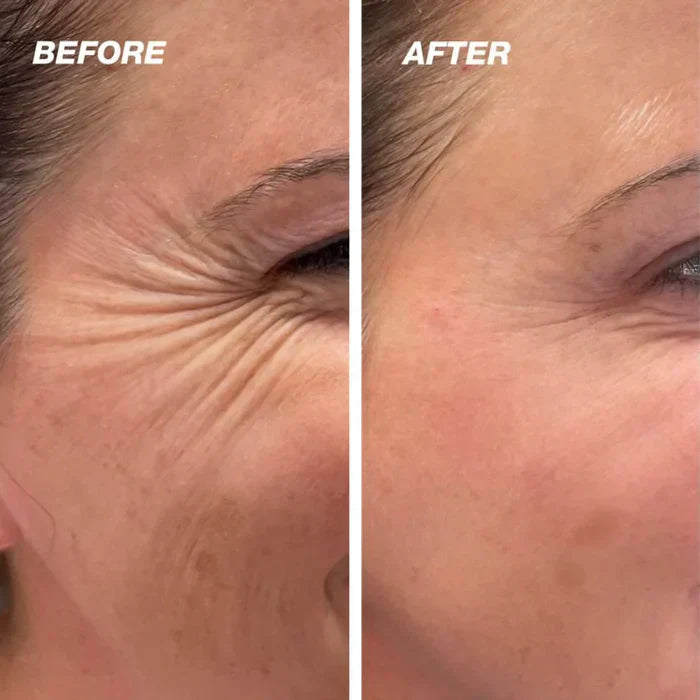 1+1 Gratis | GlowScar™ – Silikon-Narbenentfernungsfolien