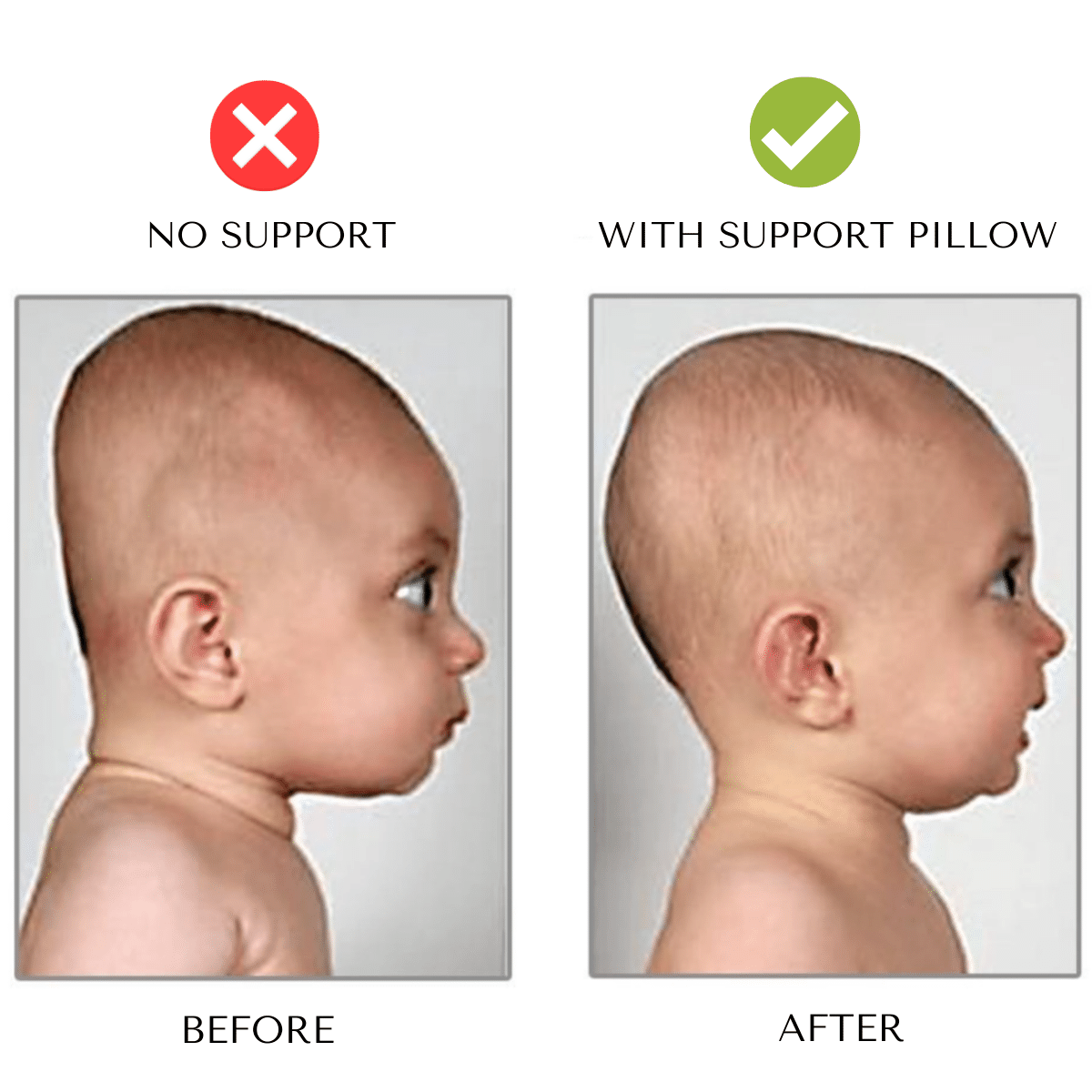 1+1 Gratis | PillowNeck™ – Orthopädisches Babykissen