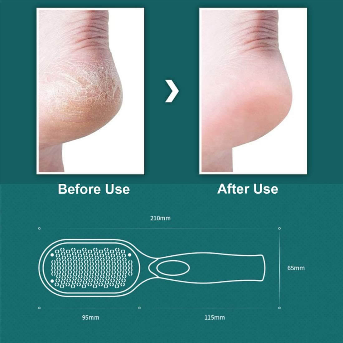 PeelPro™ – Hornhautentferner für die Füße