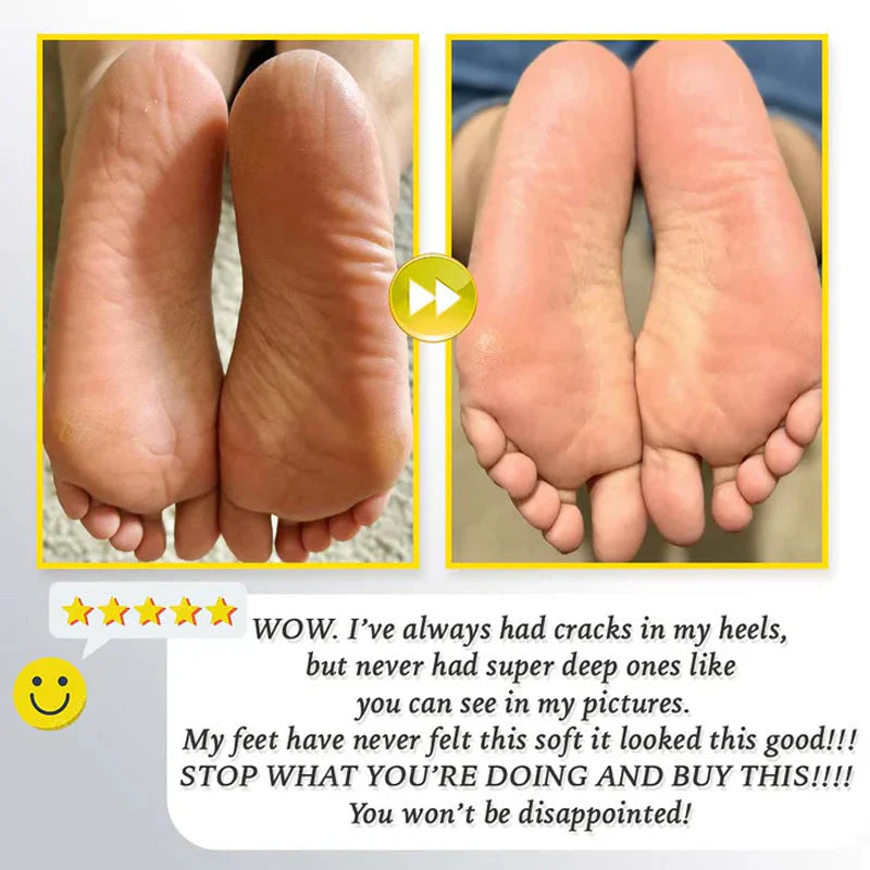 CleanHeel™ – Sanfte Hornhautentfernung für weiche, glatte Füße