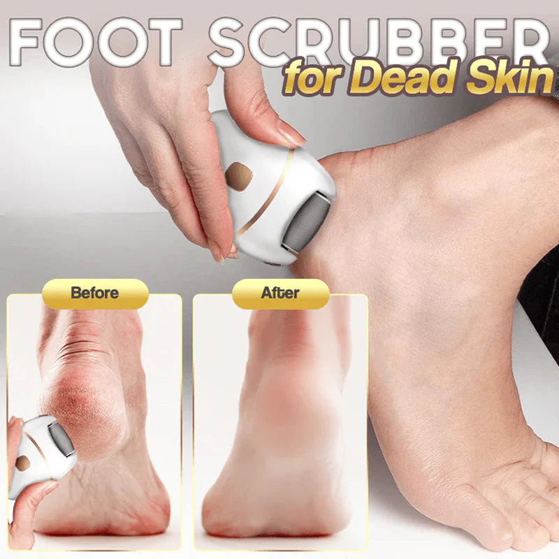 CleanHeel™ – Sanfte Hornhautentfernung für weiche, glatte Füße
