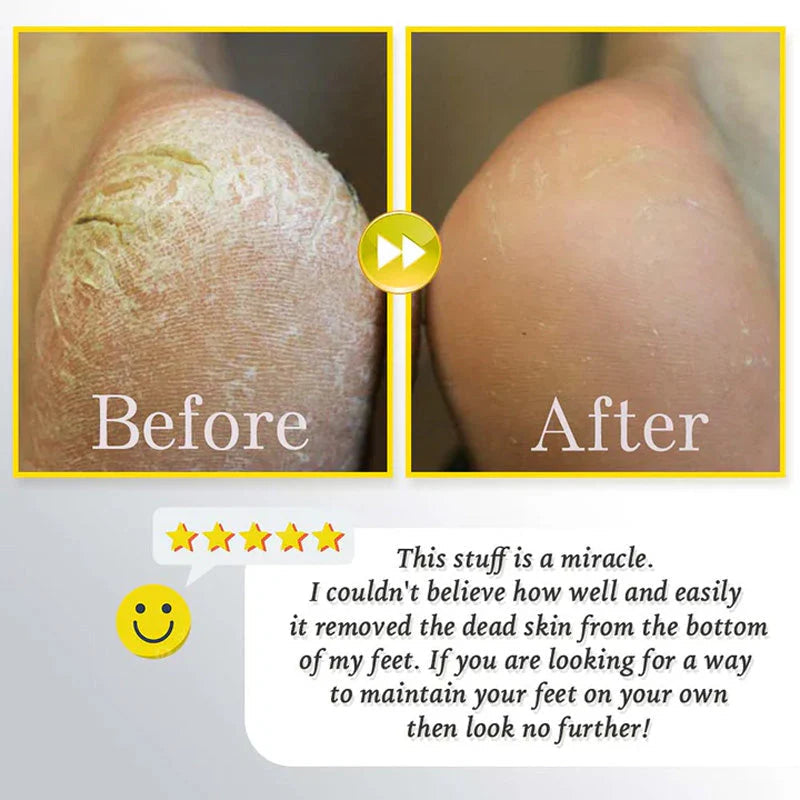 CleanHeel™ – Sanfte Hornhautentfernung für weiche, glatte Füße