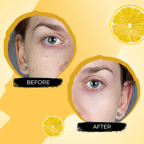 1+1 Gratis | Turmeric Serum - Concealer für dunkle Flecken