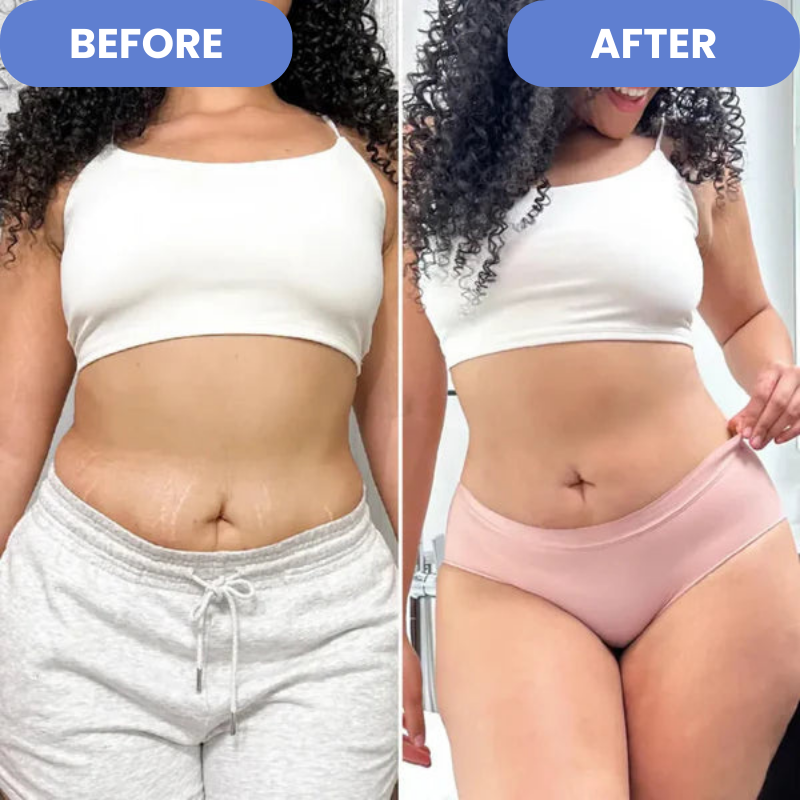 CelloSafe™ – Anti-Cellulite-Massagegerät