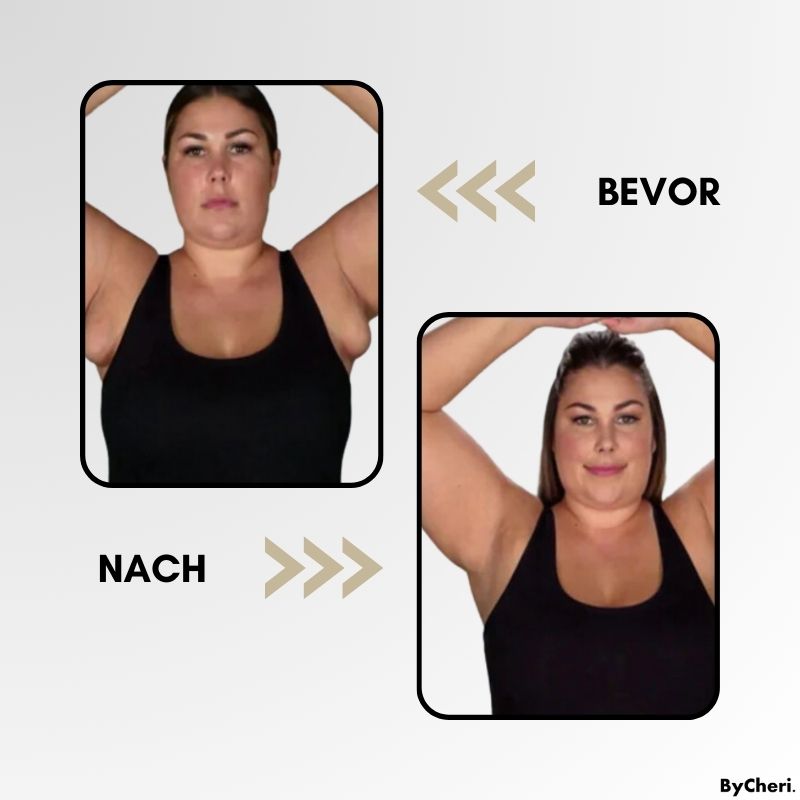 LymphMelt – Lymphstimulationsring zur Fettreduzierung und Entgiftung