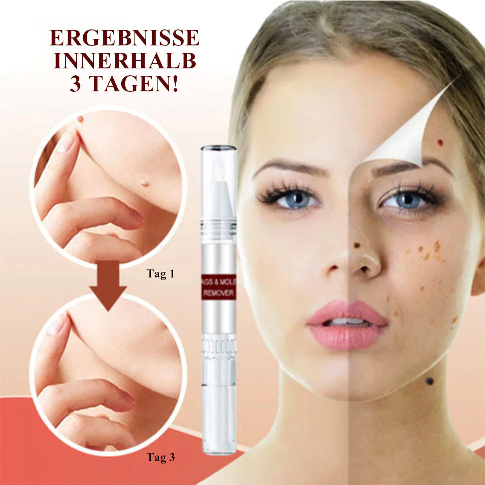 1+1 Gratis | WipeOff - Hautmakel- und Muttermal Entferner