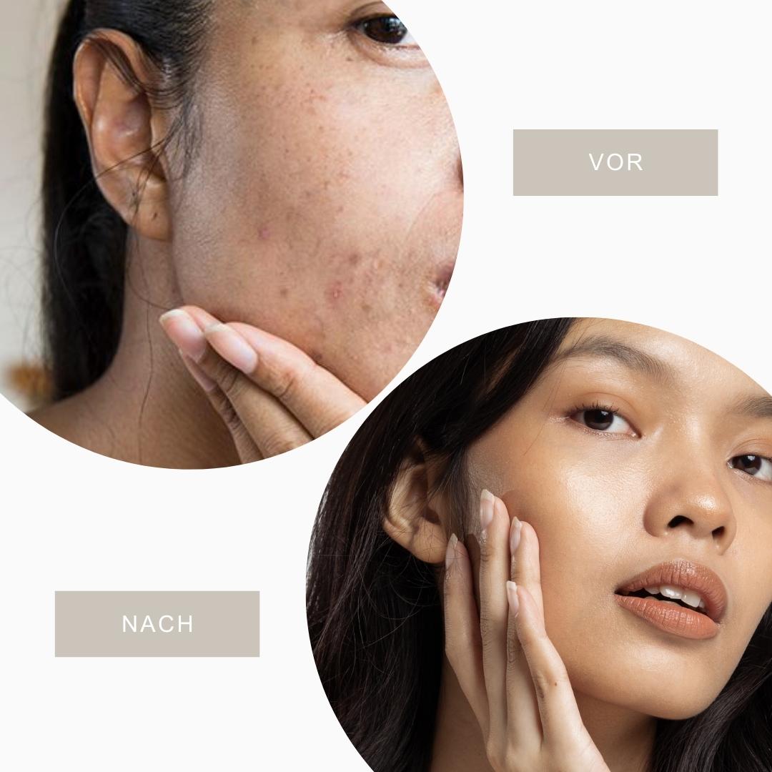 CC Creme Cushion für Damen | Hyaluronsäure & Vitamin E, 150 g | Deckt Falten, Akne & Rötungen ab, wasserfest mit SPF 20 3