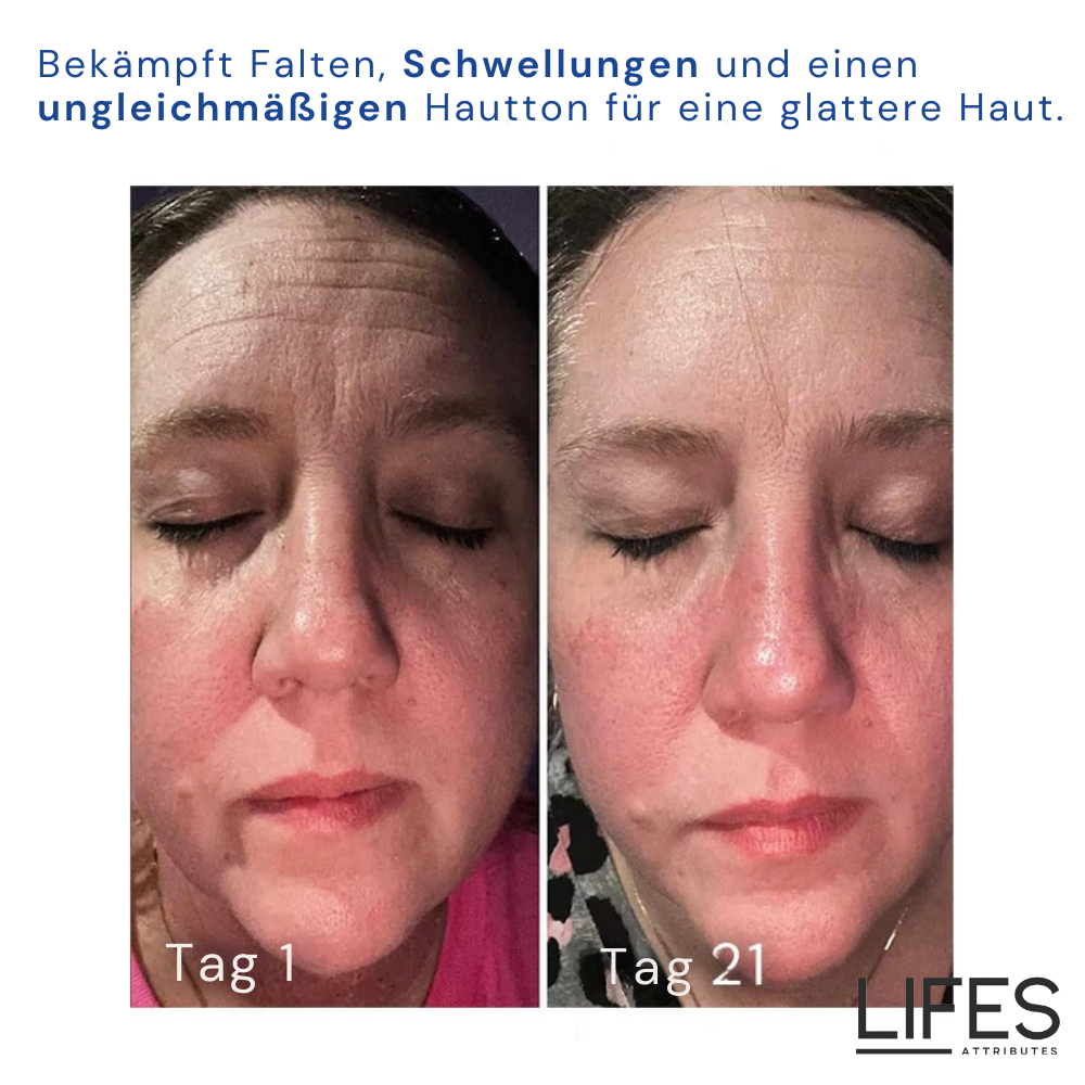 DermaCream™ - Retinol-Creme für strahlende Haut