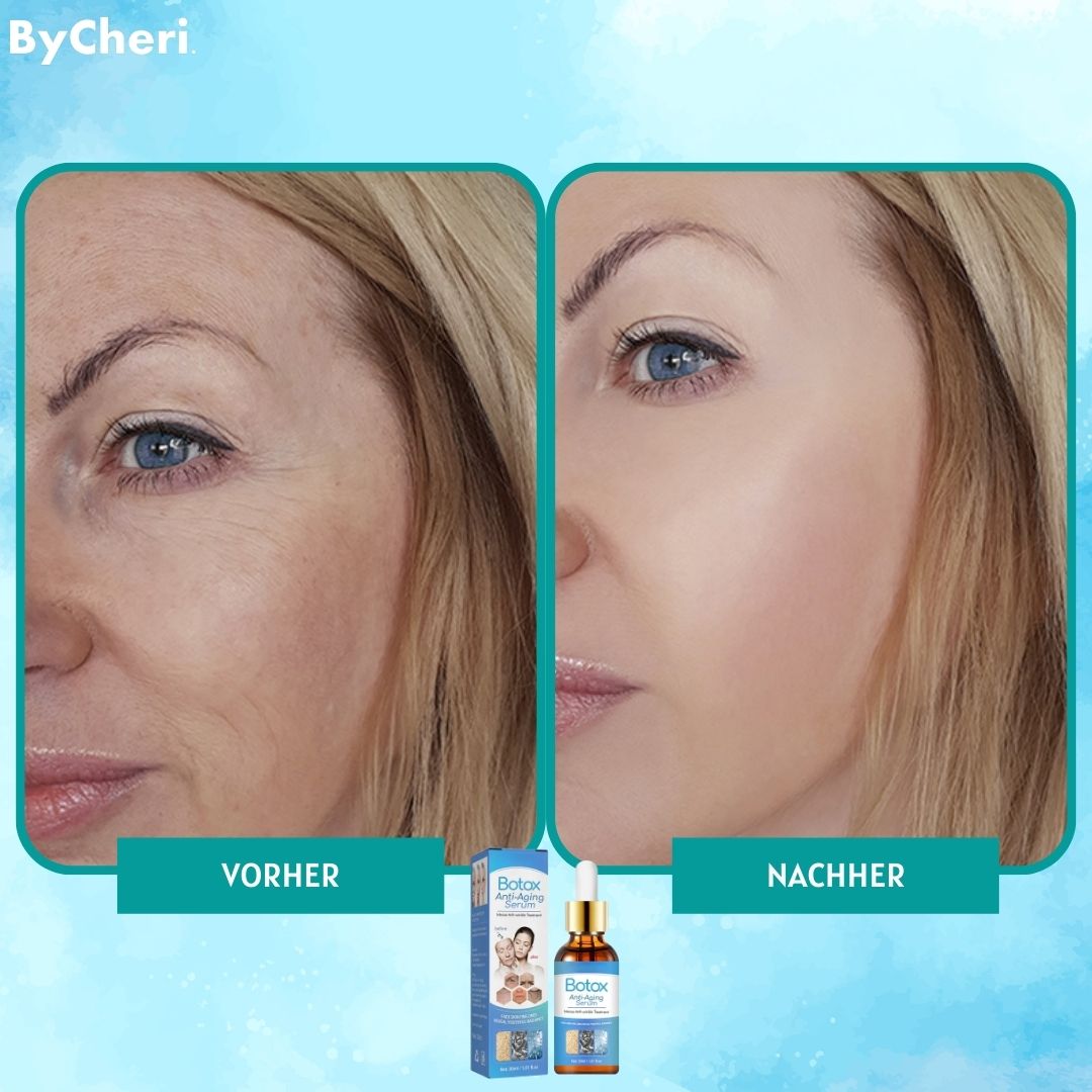 1+1 Gratis | YouthGlow - Botox Antialterung Serum