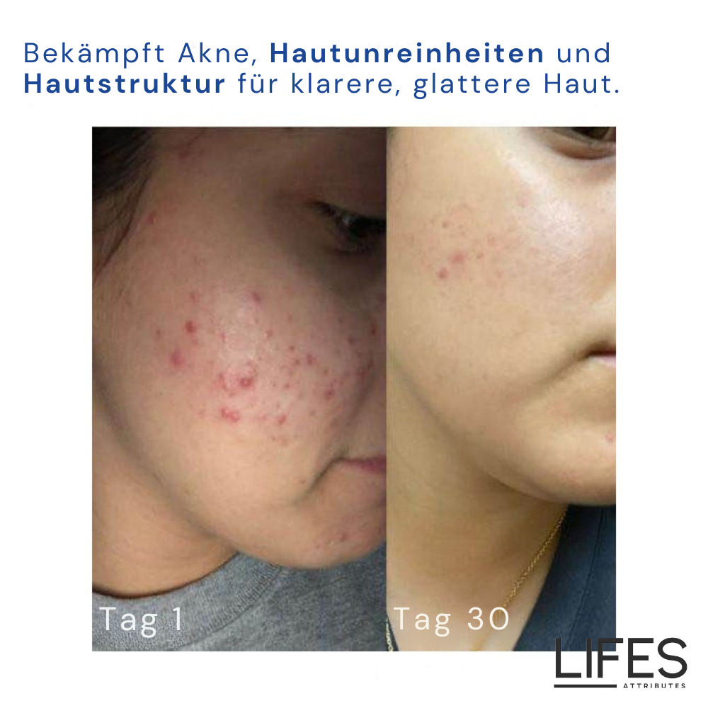 DermaCream™ - Retinol-Creme für strahlende Haut
