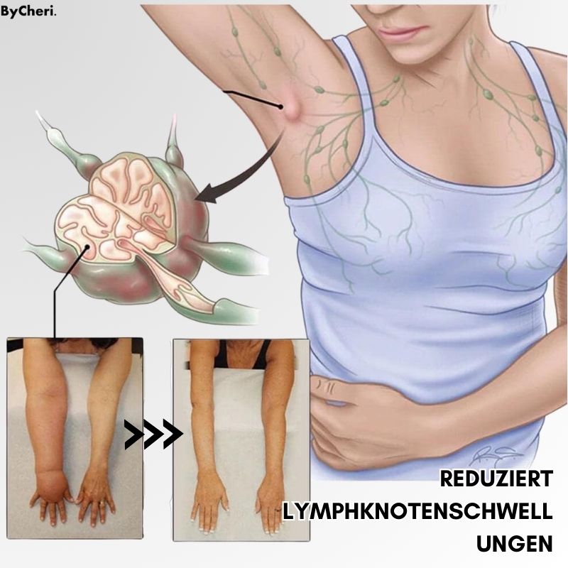 LymphMelt – Lymphstimulationsring zur Fettreduzierung und Entgiftung