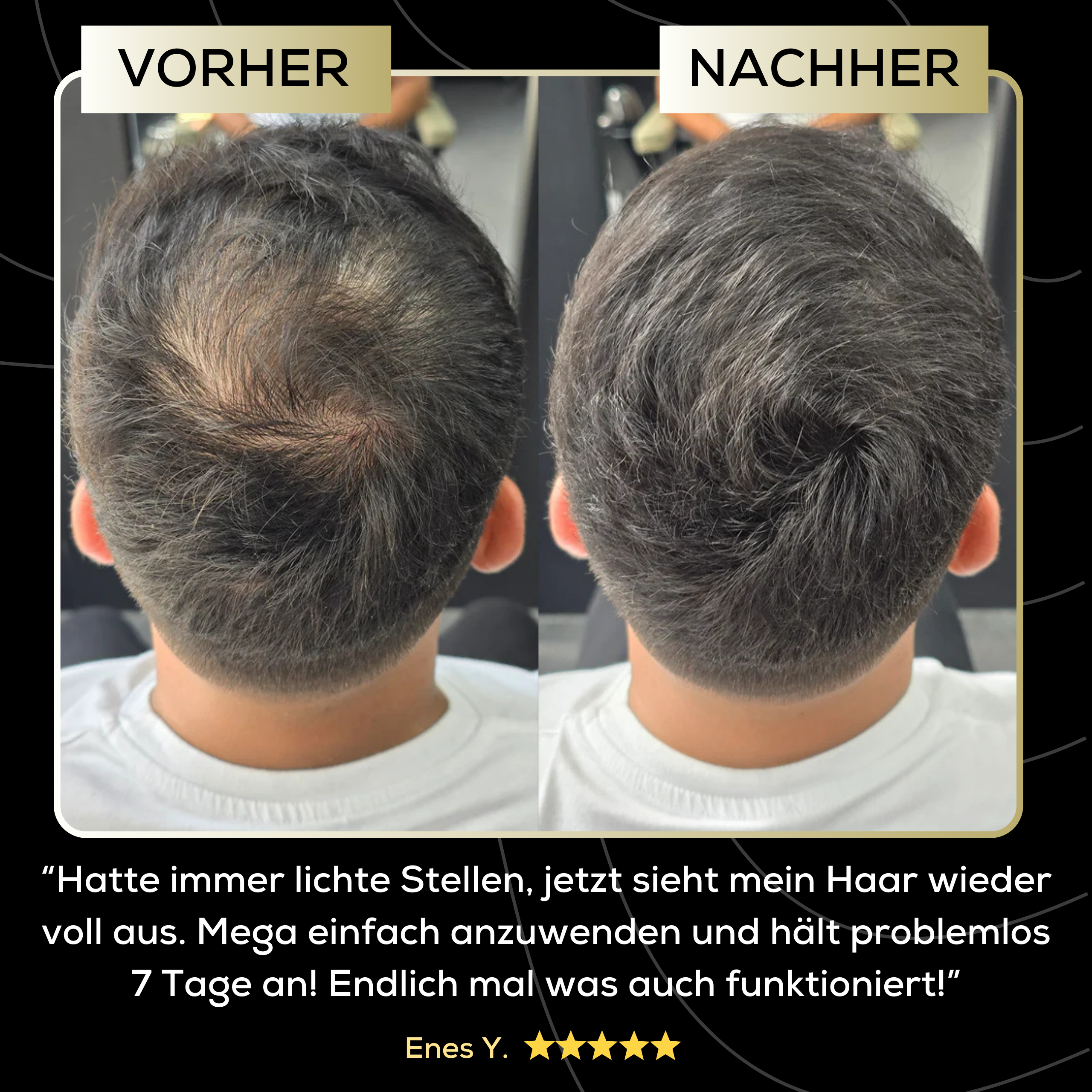 ScalpFiller™ – Unsichtbare Kopfhautfarbe für dichteres, volleres Haar
