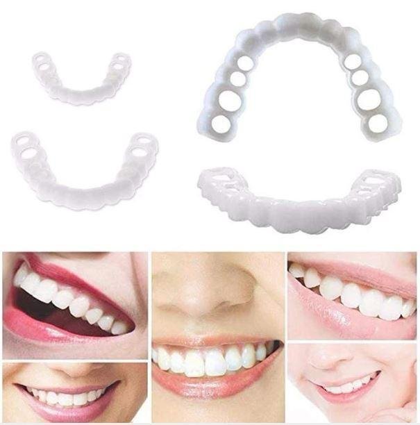 DentureSnap™ – Sofortige Snap-On-Veneers