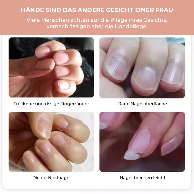 1+1 Gratis | SeraNail – Nagel-Wachstumsöl