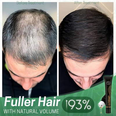 1+1 Gratis | GlowingLocks - Bio-Haarserum-Roller