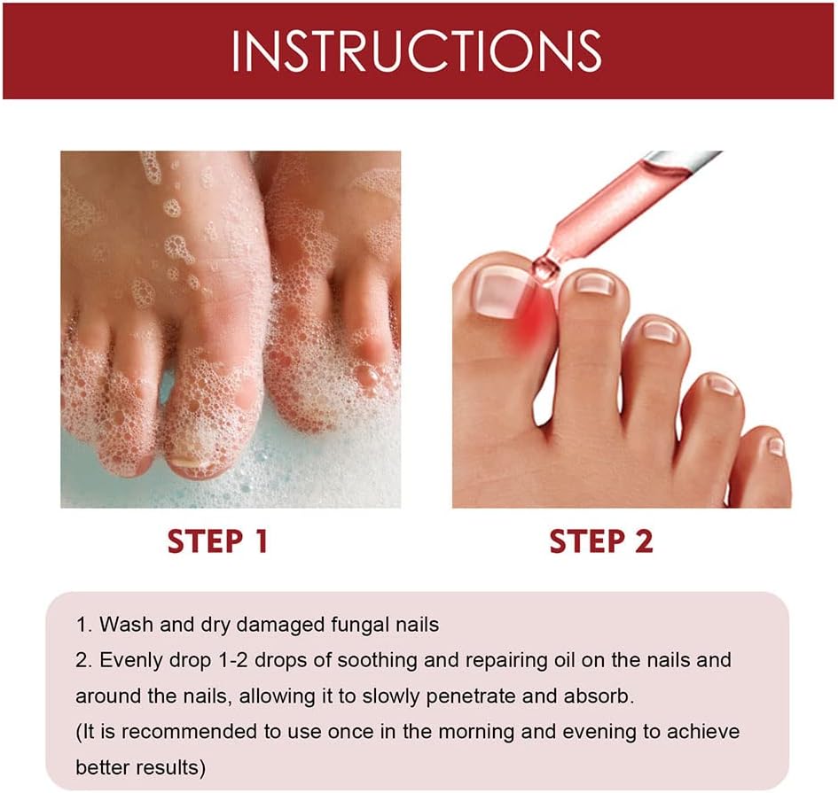 1+1 Gratis | DropToes – Nagelreparatur-Serum