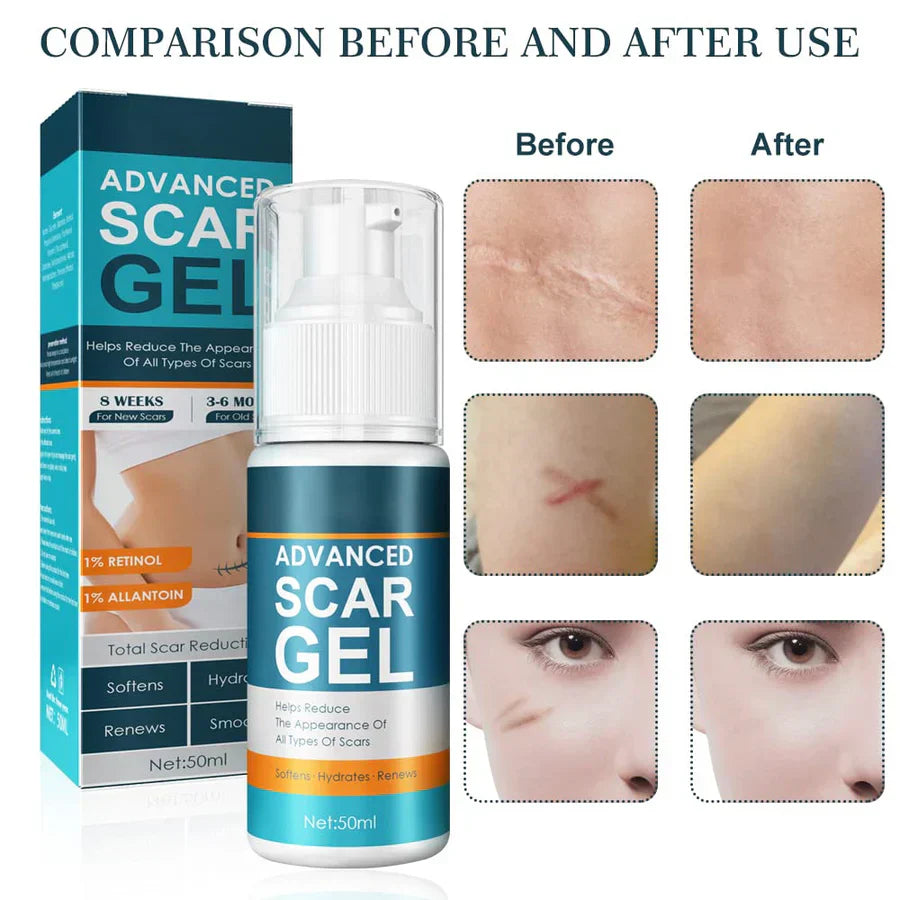 1+1 Gratis | ScarEraser™ – Gel zur Narbenentfernung
