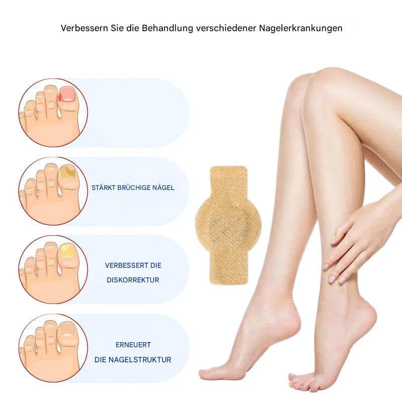 1+1 Gratis | Nailoxx™ – Diskrete antimykotische Nagelpflaster