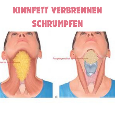 1+1 Gratis | FaceShape™ - Vakuum-Gesichtstrainer