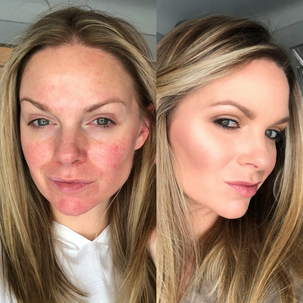1+1 Gratis | FaceFinish - Verjüngende Formel