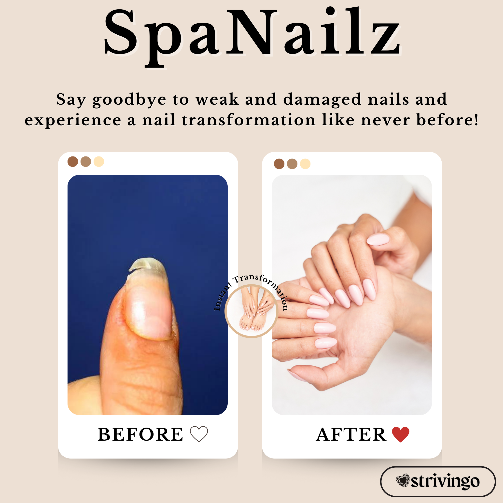 SpaNails™ – 3-in-1-Nagelreparaturset