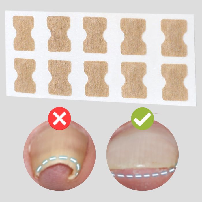 PatchCorrect™ - Korrekturpflaster für schöne und gesunde Nägel