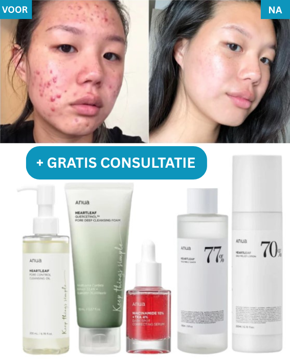 KoreanSet™ – Komplettes koreanisches Hautpflegeset für klare, strahlende Haut