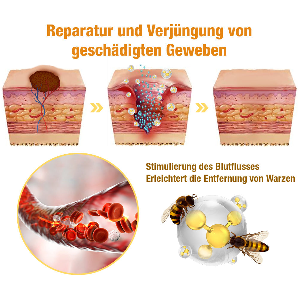 1+1 Gratis | DermiClear - Bienengift-Spray zur Entfernung von Warzen und Muttermalen