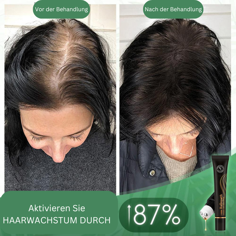 1+1 Gratis | BoostHair™ - Bio-Haarserum-Walze