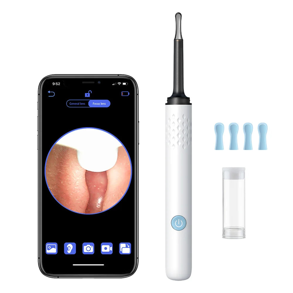 EarVision™ – Fortschrittliche Ohrreinigung mit HD-Kamera für gesündere Ohren