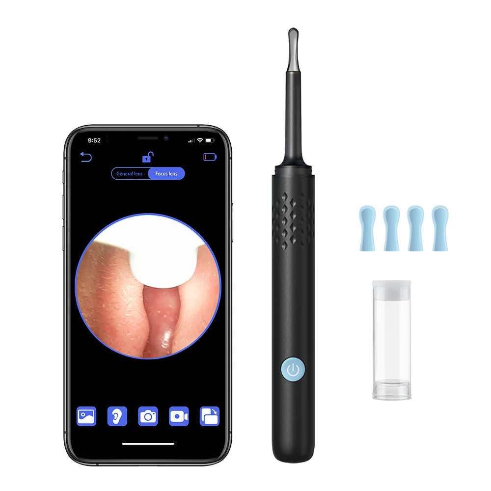 EarVision™ – Fortschrittliche Ohrreinigung mit HD-Kamera für gesündere Ohren