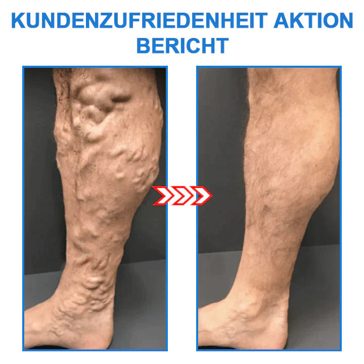 1+1 Gratis | ShapeSocks™ - Schlanke Beine und straffe Haut in einem Schritt!
