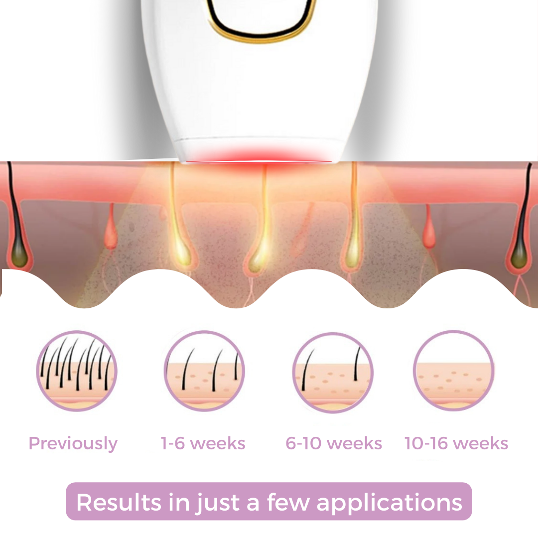 GlowSoft™ – Haarentfernungsgerät Schmerzfreier Laser-Haarentferner für Frauen und Männer