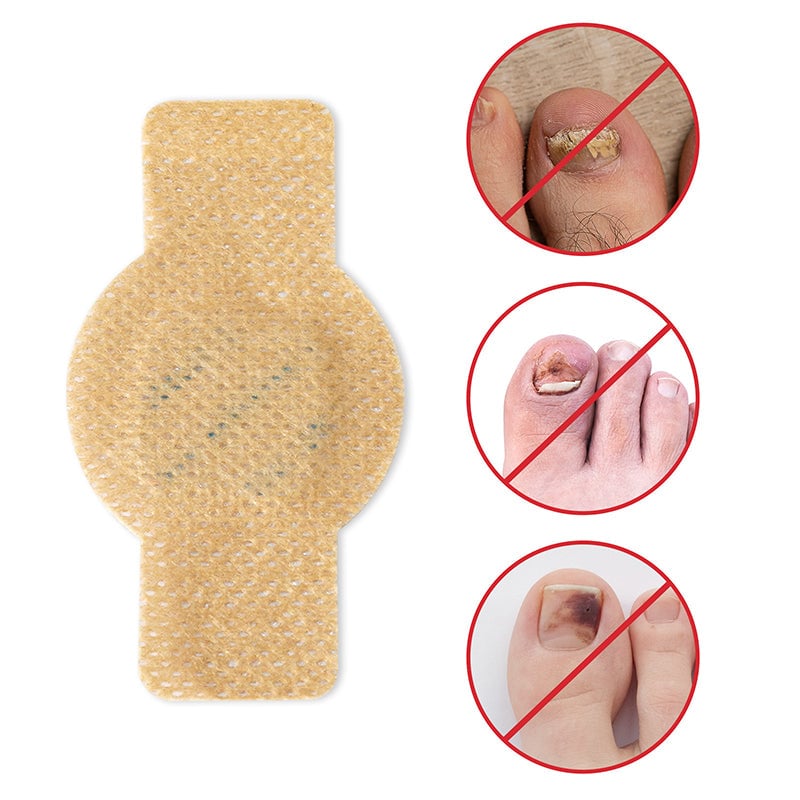 1+1 Gratis | Nailoxx™ – Diskrete antimykotische Nagelpflaster